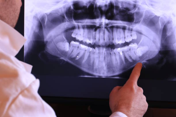 Best Tooth Pain Emergency Relief  in Kingston Estates, NJ